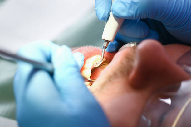 Best Emergency Gum Pain Relief  in Myrtle Point, OR