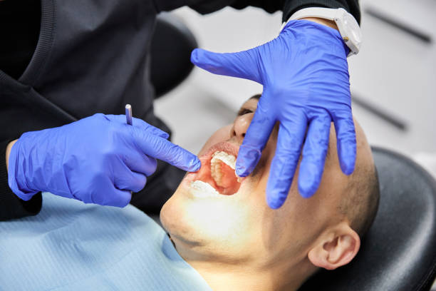Best Chipped Tooth Repair Near Me  in Myrtle Point, OR